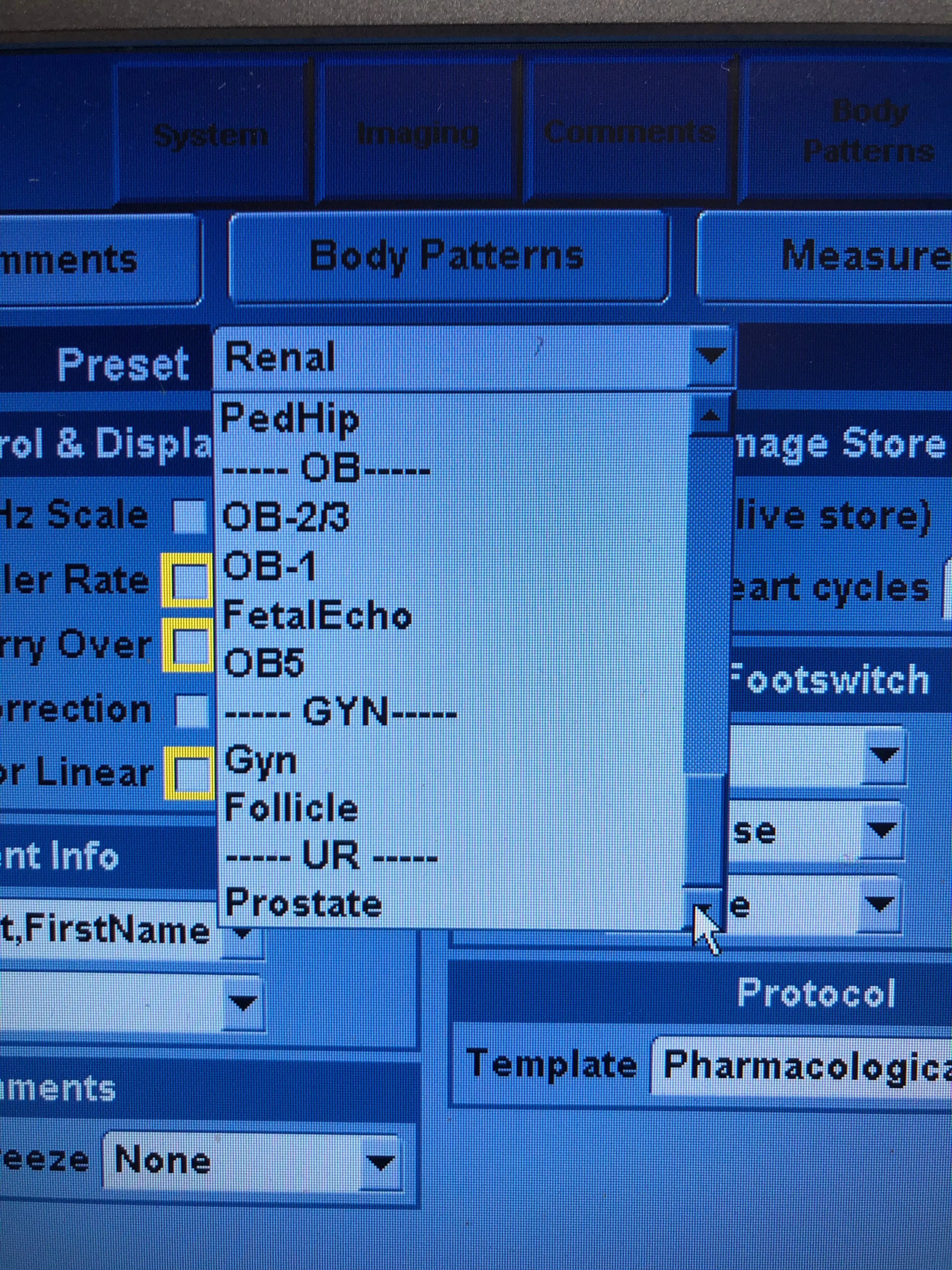 Used GE Vivid E With Phased Array and Linear Probes