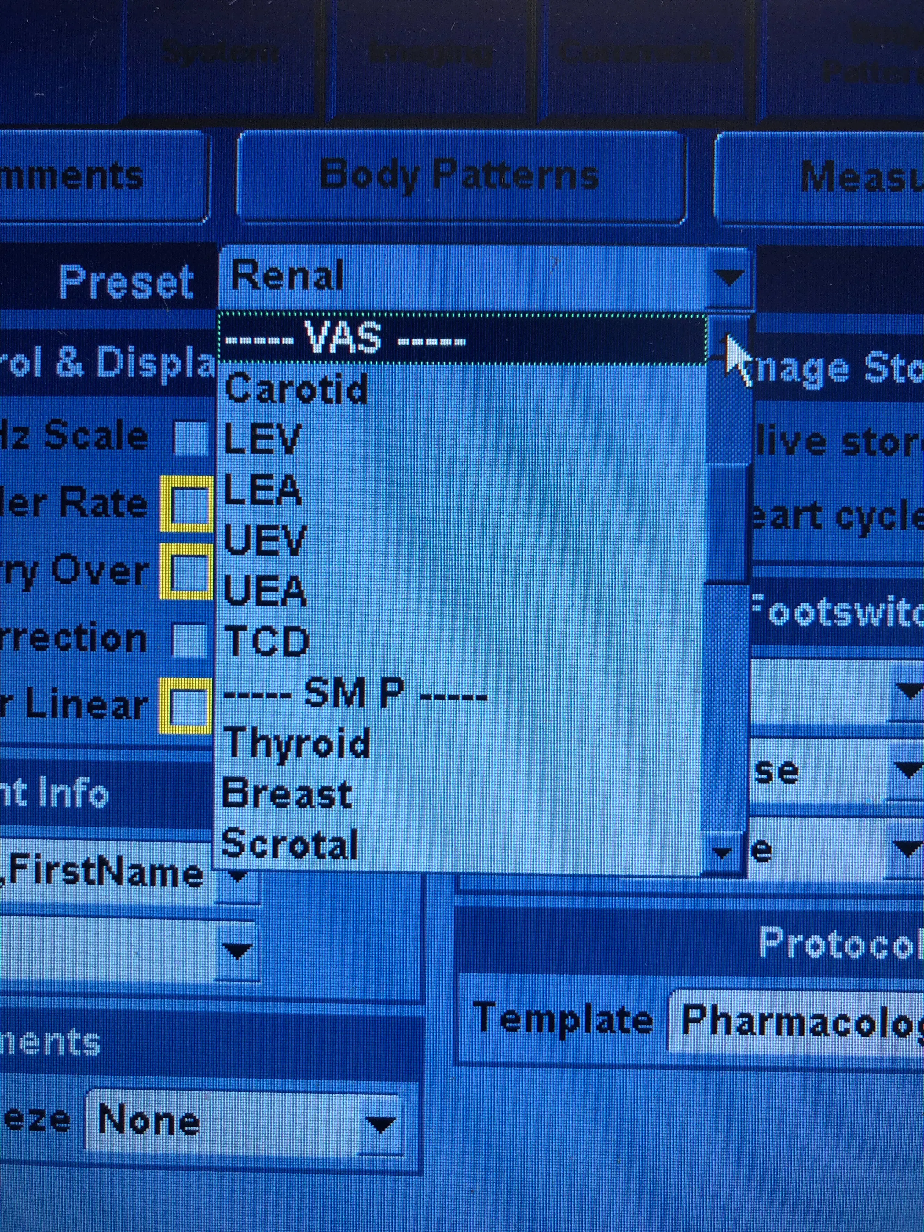 Used GE Vivid E With Phased Array and Linear Probes